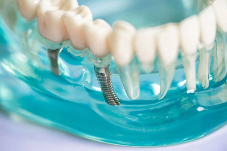 What guarantee does dental treatment have?