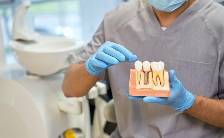 Immediate Loading Techniques – The Future of Dental Implants