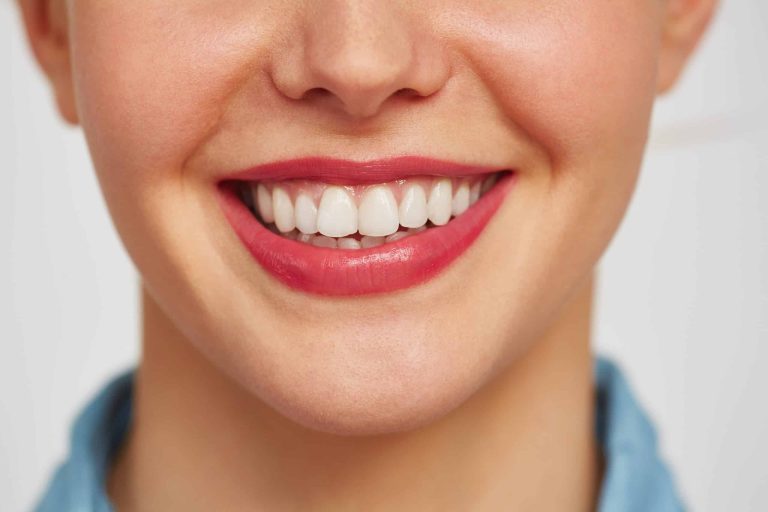 Woman with white teeth