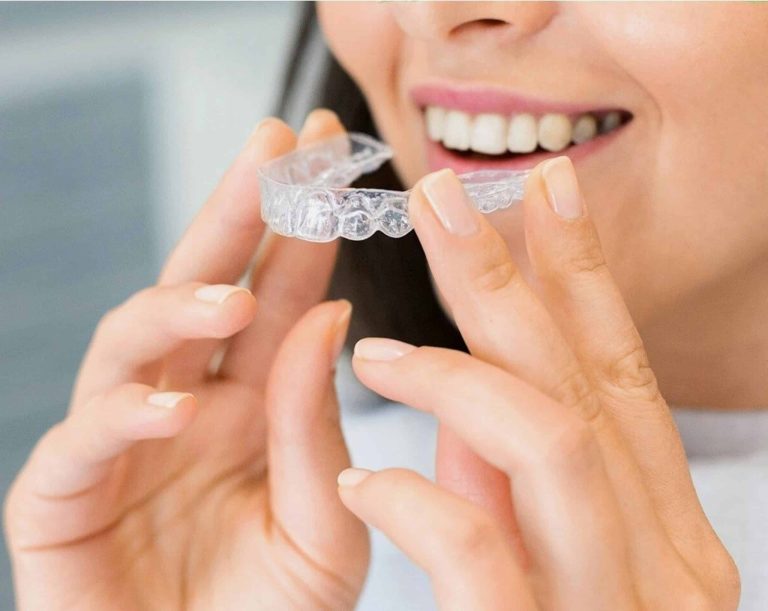 Invisible Aligners, woman