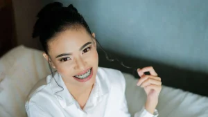 Braces smile
