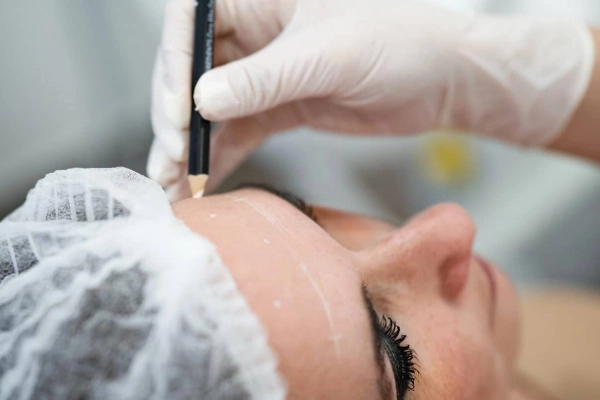 Harmonização facial