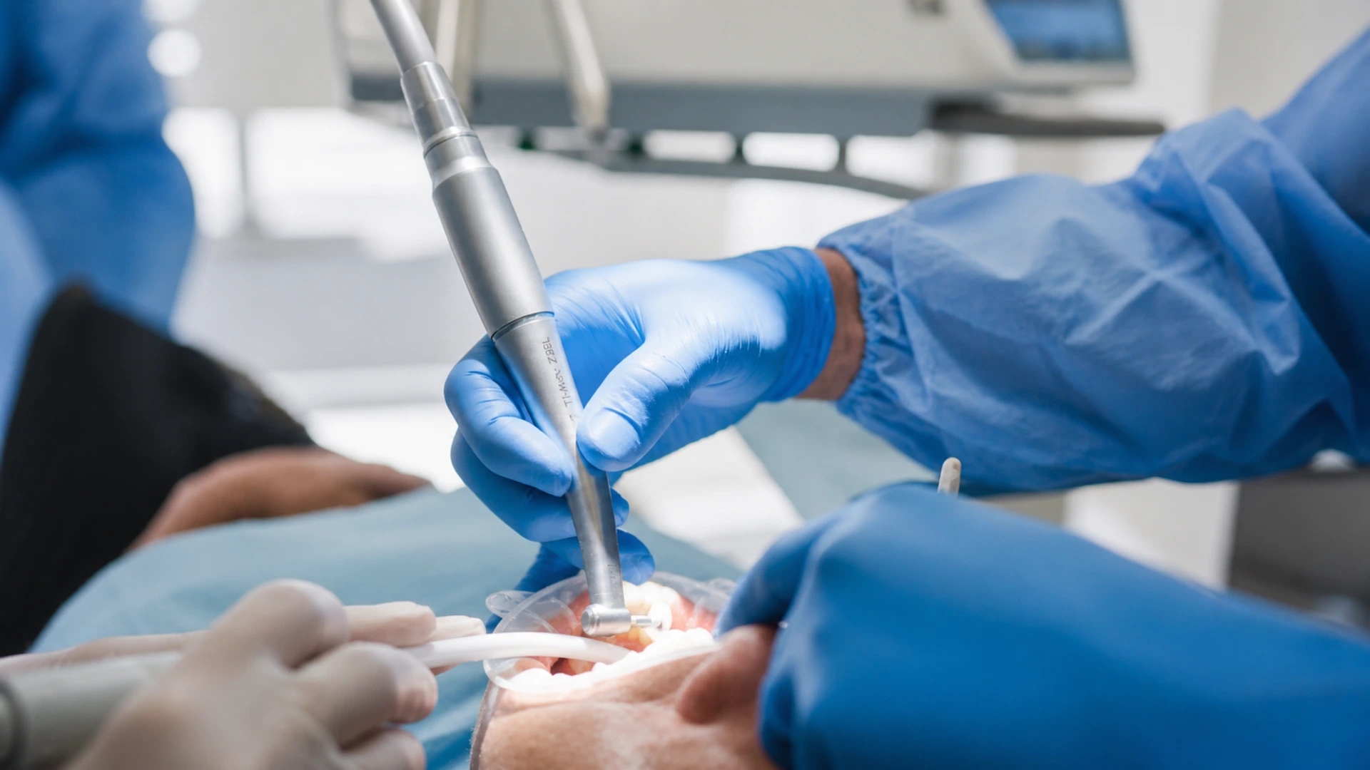 Perguntas frequentes sobre implantes dentários na Clínica Dr. Pedro Coelho em Oeiras